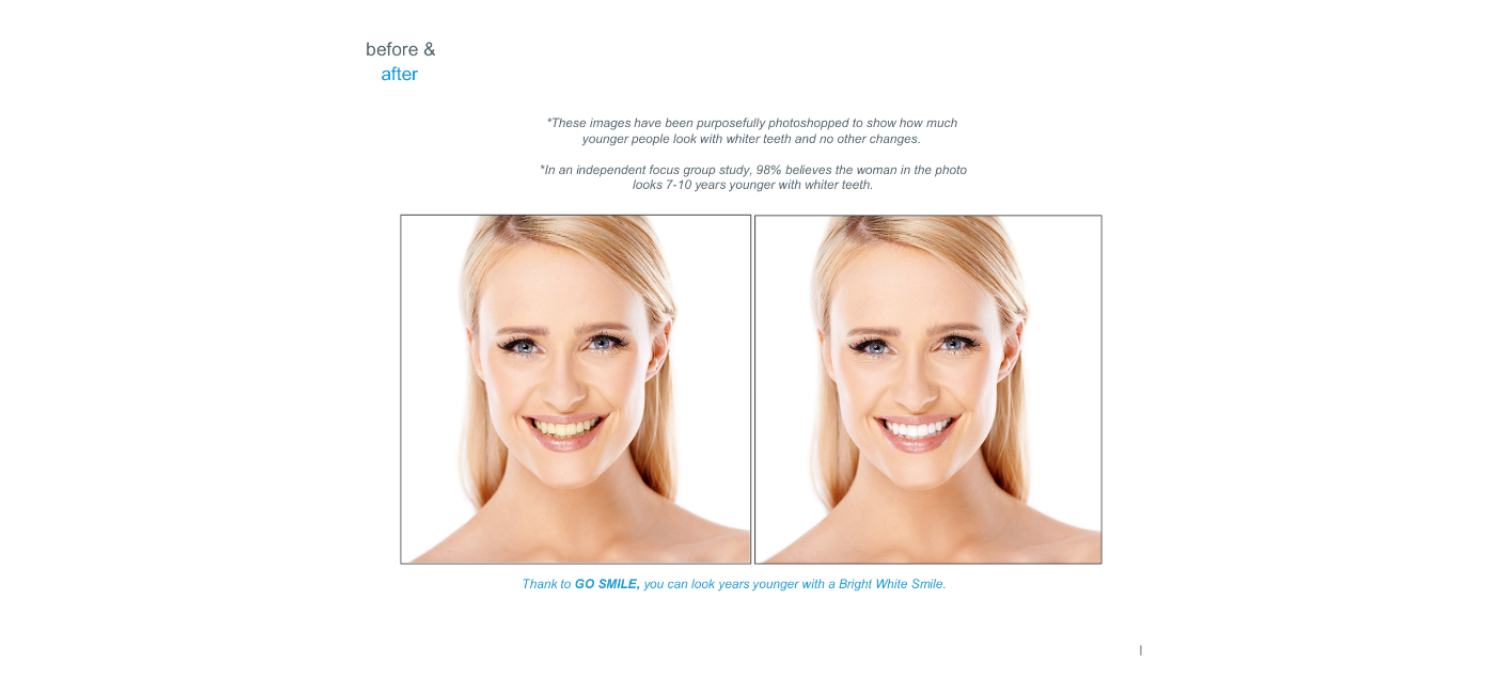 How Your Yellow Smile Ages You
