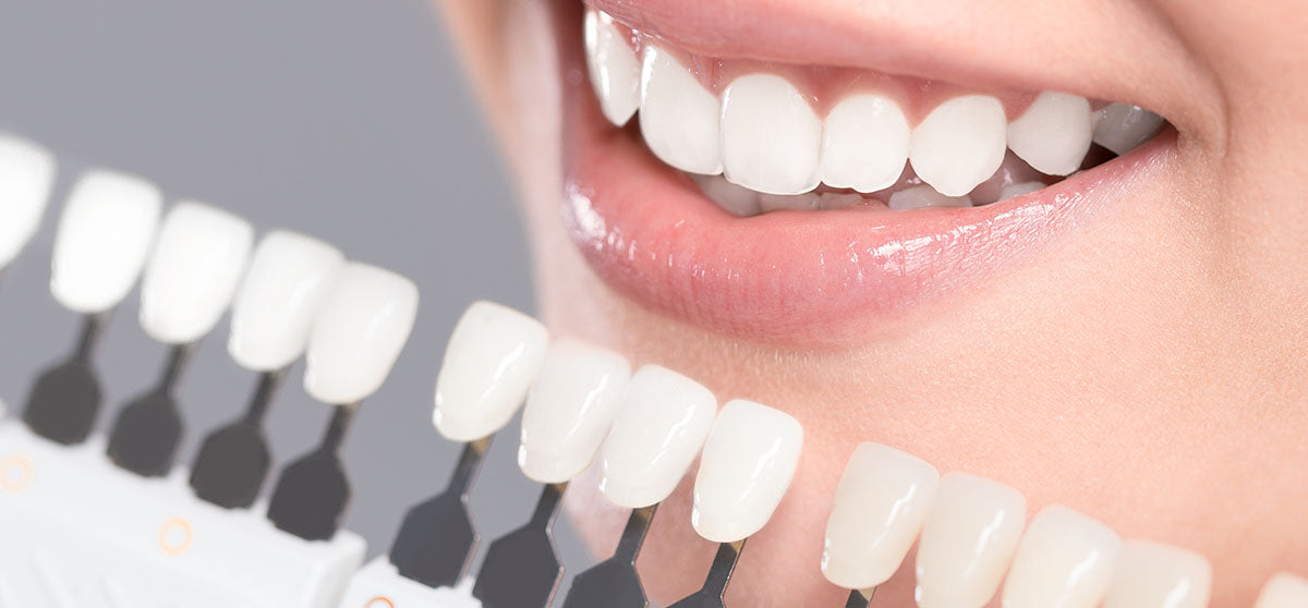 Matching the shades of dental implants
